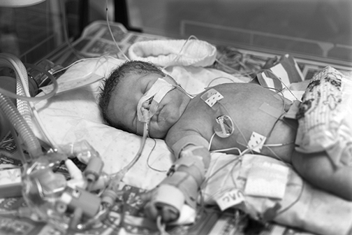 preemie in NICU